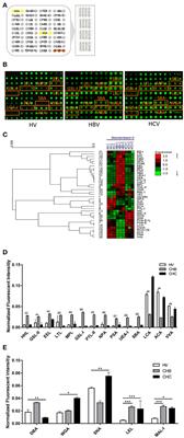 Comparative Analysis for Glycopatterns and Complex-Type N-Glycans of Glycoprotein in Sera from Chronic Hepatitis B- and C-Infected Patients